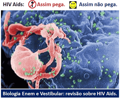 HIV Aids