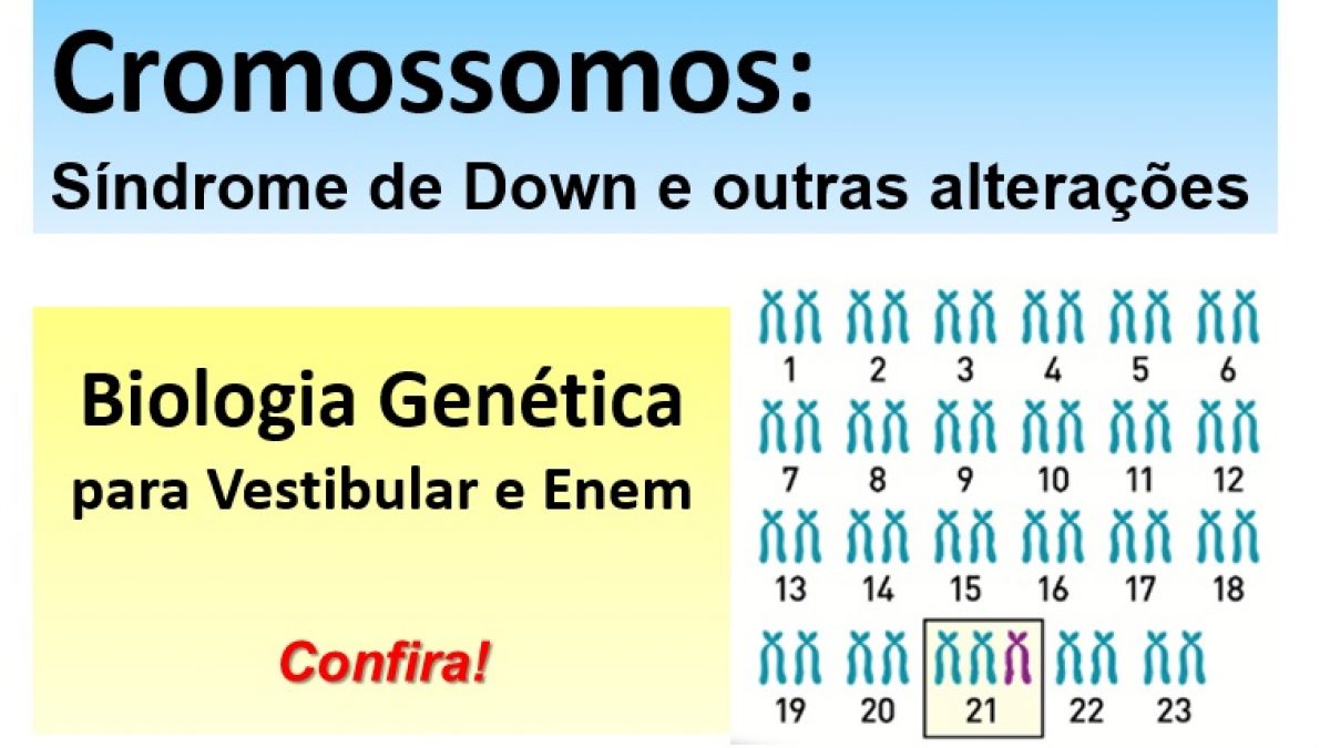 A Trissomia Do Cromossomo 21 E Um Exemplo De