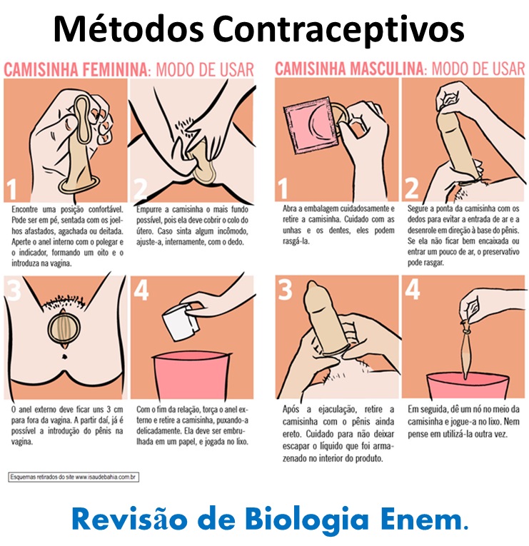 Métodos para evitar a menstruação: quando a mulher deve recorrer a eles?