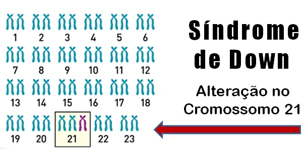 Síndrome de Down e outras alterações cromossômicas - Biologia Enem