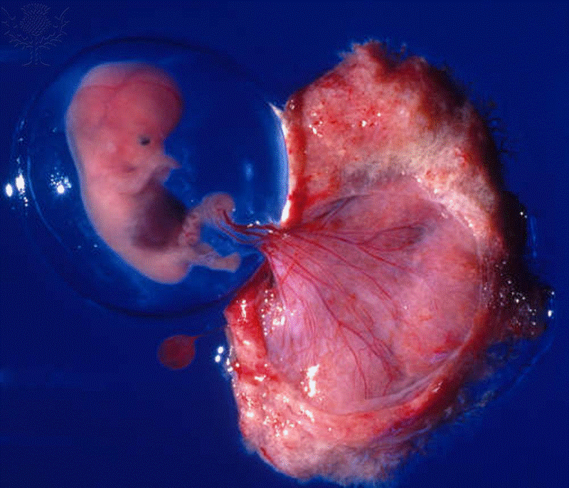 placenta anexos embrionários