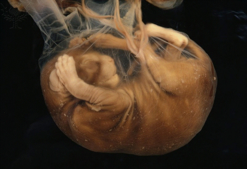 feto anexos embrionários