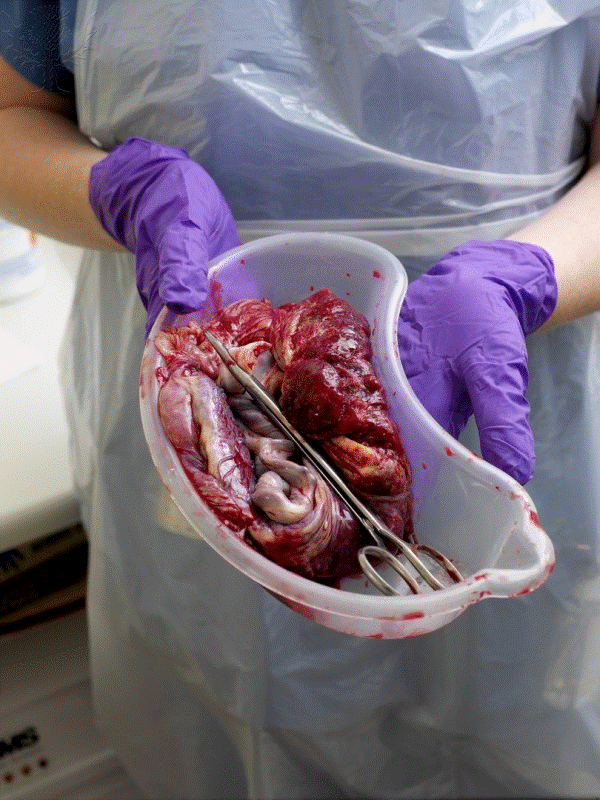 placenta anexos embrionários