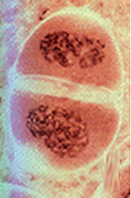 prófase II, meiose, divisão celular